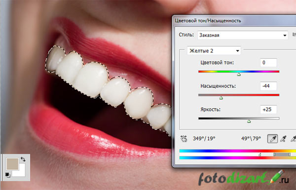 цветовой тон настроенный отбеливание зубов