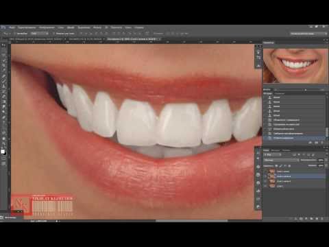 Корректируем зубы в Photoshop