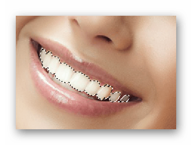 Выделение зубов в Photoshop-online