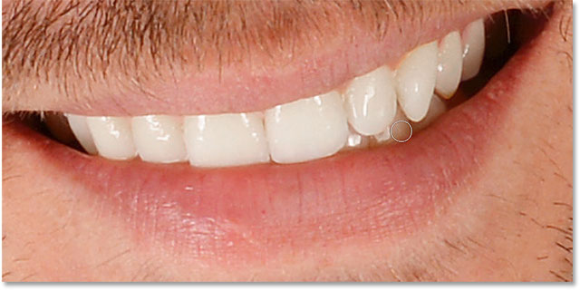 Adjusting the whitening and brightening of specific teeth in the image