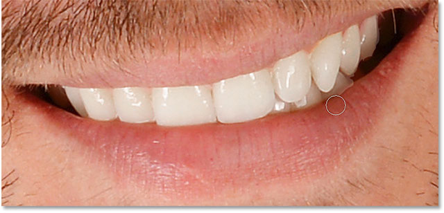 Hiding the whitening and brightening effect from the areas below the teeth