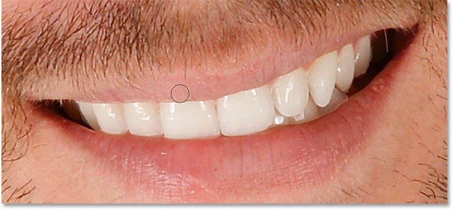 Hiding the whitening and brightening effect from the areas above the teeth