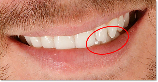 Some of the teeth look faded and washed out after brightening.